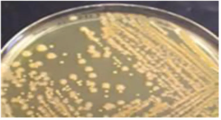 Figure 03 : Aspect des colonies de Klebsiella pneumoniae sur milieu gélosé   (Gueye, 2007) 