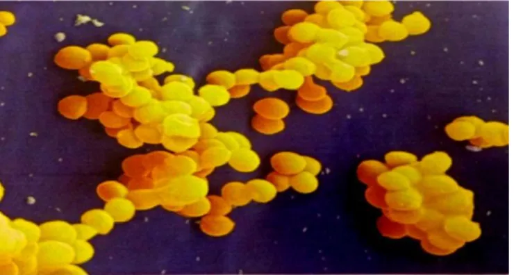 Figure 05 : Staphylococcus aureus à balayage (G × 1500) (Prescott et al., 2003). 
