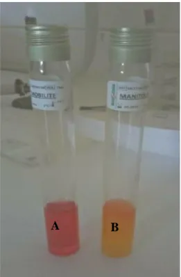 Figure 12 : Aspect du milieu Mannitol mobilité (photographie originale) ; A : Mannitol  mobilité négatif, B : Mannitol mobilité positif