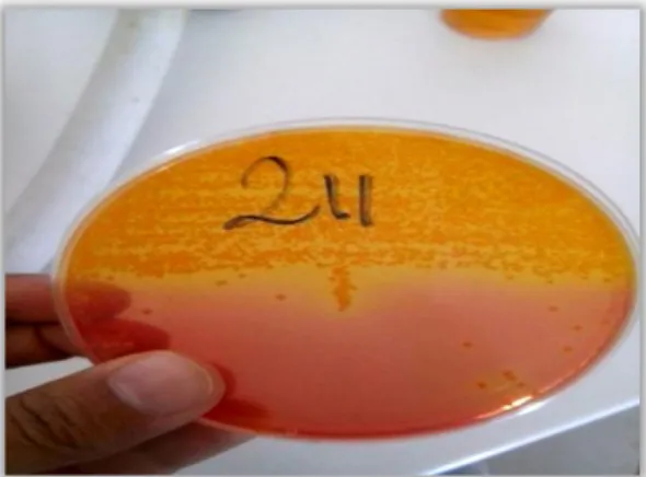 Figure 17 : Aspect des colonies Staphylococcus aureus sur milieu Chapman  (photographie originale) 