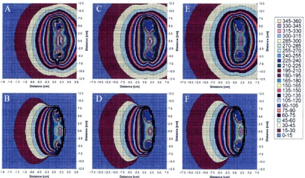 Figure  2.2.3:  Dose  [Gy]  for  a  16  mm  COMS  eye  plaque  with  SK  per  seed  to deliver  DR,  (5 mm)  =  85  Gy