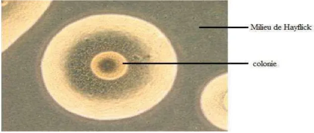 Figure 07: Colonies d’Ureaplasma au microscope optique  sous forme d’oursin [9]. 