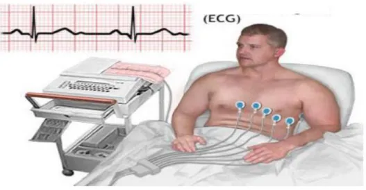 Figure 1.5.  Électrocardiogramme [6]. 