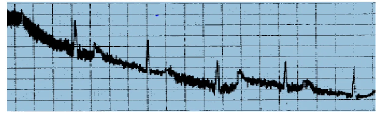 Figure I.19. Fluctuations de la ligne de base [16]. 