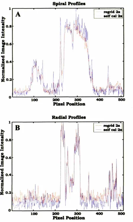 FIG U R E 2.5 Image Intensity Promes of 2:1:Spiral and Radial Images