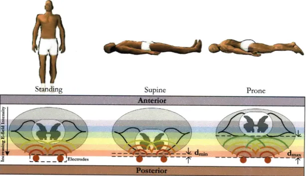 Figure  2-3:  Spinal  cord  movement  in  the spinal  column  due  to body  orientation.