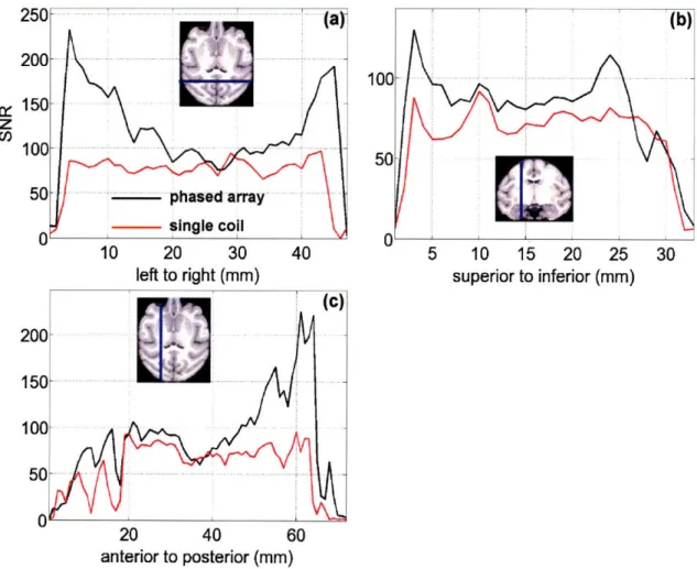 Table  2-1.  Relative  SNR  (±  SEM)  in  the  phased  array  coil relative  to  the  single  coil  in  primary  visual  cortex  (VI),  the frontal  eye  fields  (FEF),  and  the  lateral  geniculate  nucleus (LGN)  in  the  left  and  right  hemispheres  