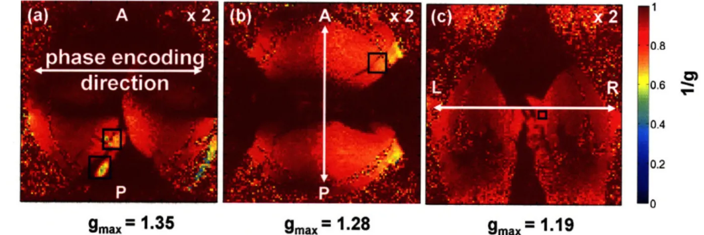 Figure  2-4.  1/g-factor  maps  for  the  (a)  left-right  horizontal,  (b)  anterior-posterior horizontal,  and  (c)  left-right  coronal  phase  encode  directions  for  two-fold  GRAPPA acceleration,  R =  2