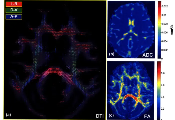 Figure  2-7  depicts  the  DTI reconstruction  of a  0.9  mm  isotropic  acquisition  in Ml