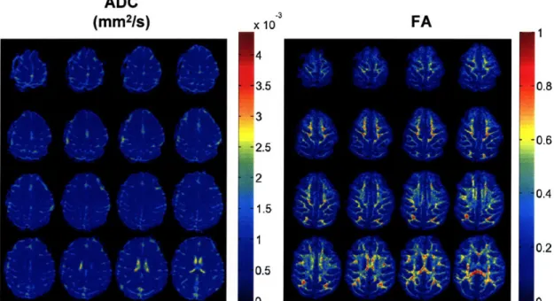 Figure 3-2.  (Left) ADC  and (Right) FA maps  calculated  from  a DTI  acquisition at 0.9  mm isotropic on  a monkey