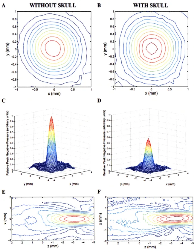 Figure  2-2:  Comparison  of beam  plots with and without  a rat  skull  in the beam  path