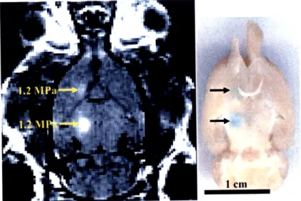 Figure  3-1:  Confirmation  of ultrasound-induced  localized  BBB  disruption  in  the  rat  brain by  MRI  and  by  trypan  blue  staining  of  the  affected  area