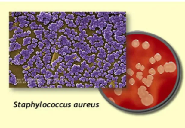 Figure 15: Photo de la bactérie Staphylococcus aureus observée sous microscope 