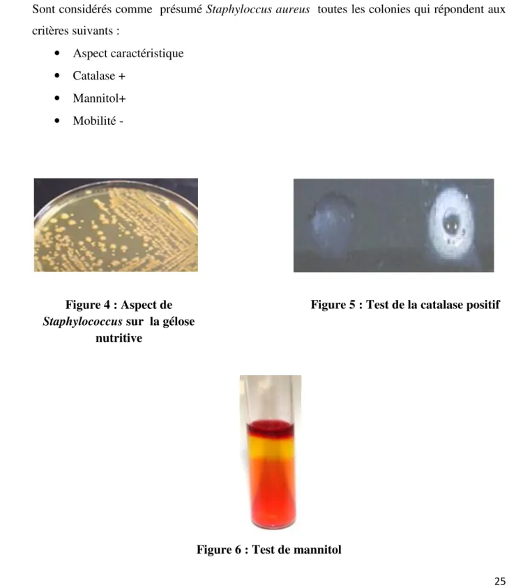 Figure 5 : Test de la catalase positif  positis 