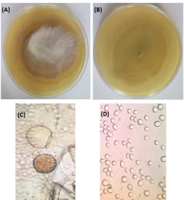 Figure 1. Macroscopic Appearance on Sabouraud Agar (Culture of 5 Days at  28°C; (A): Top, (B): bottom) and optical microscopy images (C, D) used for the  identification of the novel isolated strain, × 400.