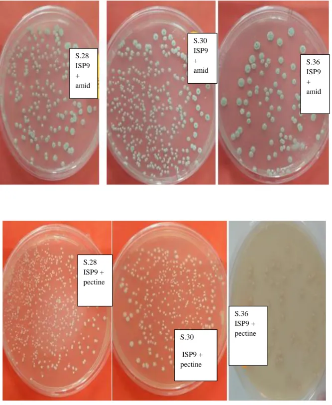 Figure 07: photo montrant le résultat de la croissance bactérienne des Streptomyces sur les  différents substrats en comparaison avec le témoin négatif