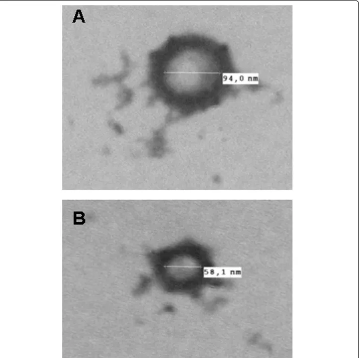 Figure 9 Negative stain of vesicle-like structure found in the secretion buffer (A) and in the rat serum (B) after Trypanosoma depletion