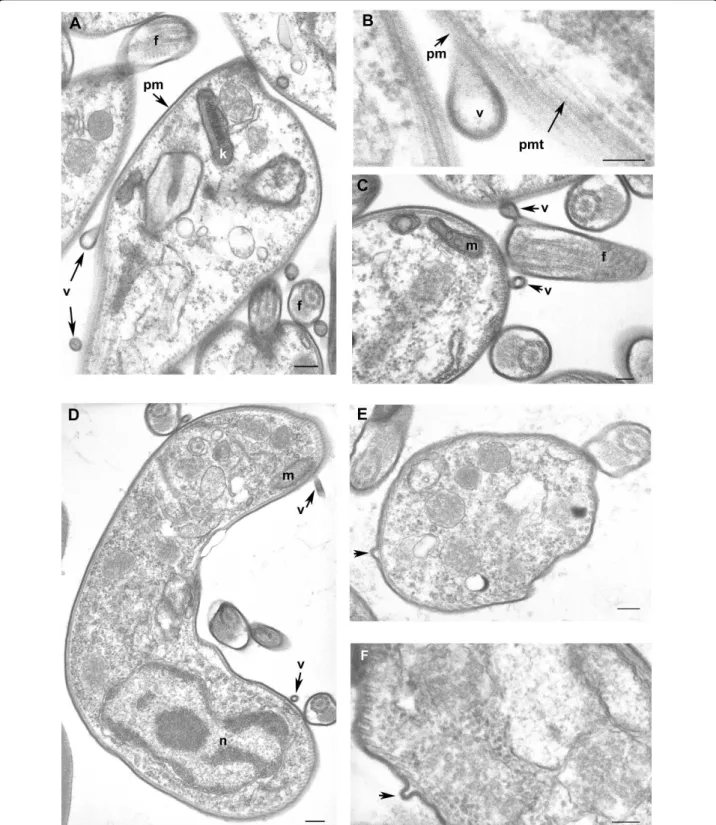 Figure 7 Cross-sections of Trypanosoma brucei gambiense purified from infected rat blood by chromatography on DEAE cellulose column and incubation in secretion medium (A, B, C) and directly after cardiac puncture of infected rat (D, E, F)