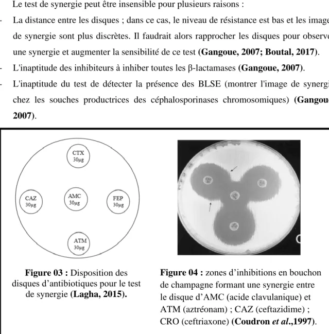 Figure 03 : Disposition des  disques d’antibiotiques pour le test 