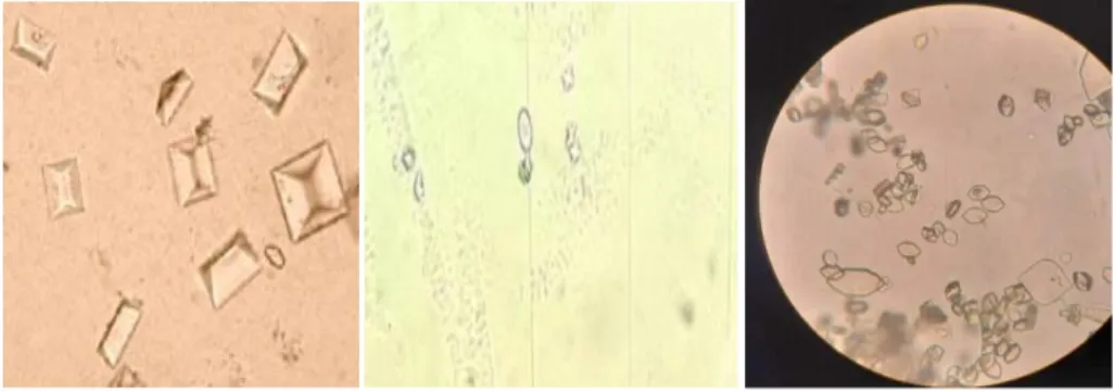 Figure 15: observation des urines sous microscope optique à GX40  (a)la flore microbienne, (b) les cellules épithéliales
