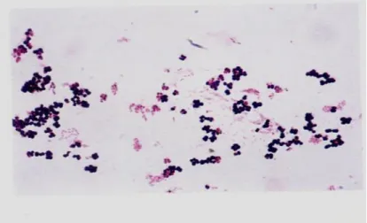 Figure  03:  Staphylocoques  en amas  (Spicer,  2003). 
