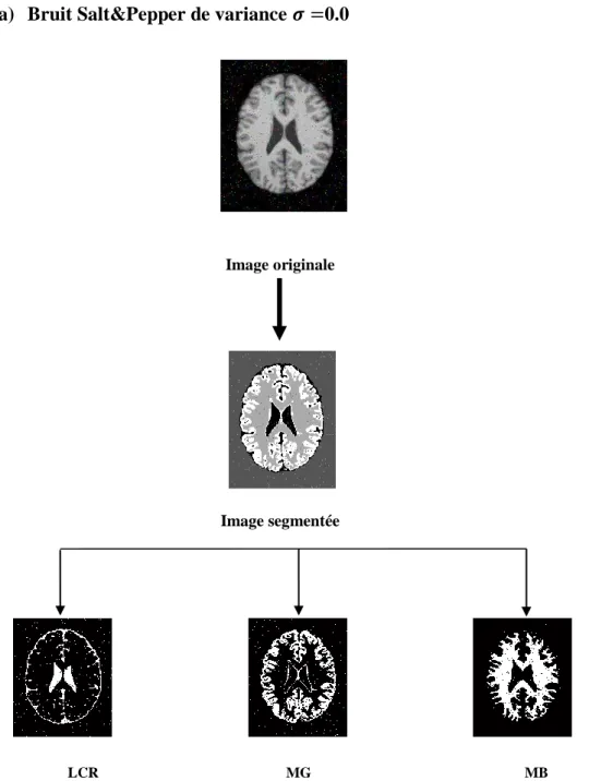 Figure III.6. Résultat de la segmentation par les K-means d’une image bruitée avec Salt &amp; Pepper