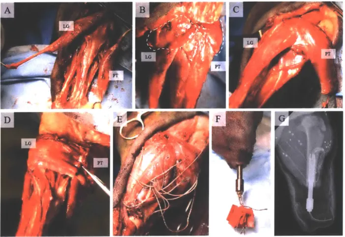 Figure  15:  Goat TF  surgical technique.  (A)  LG  and  PT  are  isolated  on their neurovascular  leashes.
