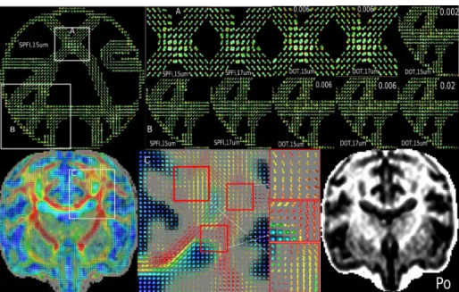 Fig. 1. First row: phantom data, from left to right: whole view of P(R 0 r), R 0 = 15µm and P(R 0 r), R 0 = 15µm,17µm in region A and B of phantom data, calculated from SPFI and DOT