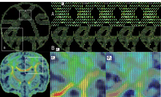 Fig. 1. First row: phantom data, from left to right: whole view of Φ w from our method, Φ w in region A and B from our method, method in [3] with λ = 0.006, 0.02, 0.03, 0.04; Second row: