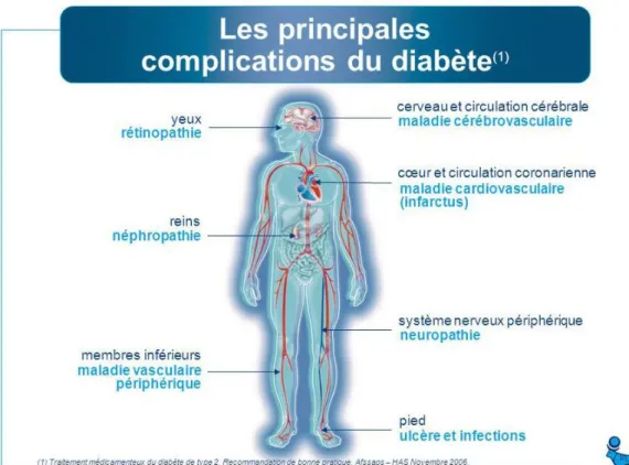 Figure 06 : Les complications du diabète (FID, 2006). 