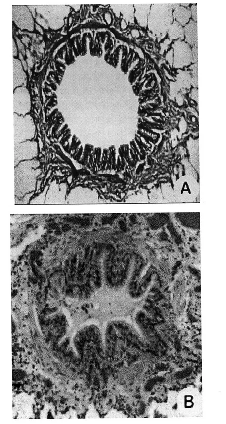 Figure 1.3:  Histological  cross  sections  of a  normal  (A)  and  asthmatic  (B)  airway.
