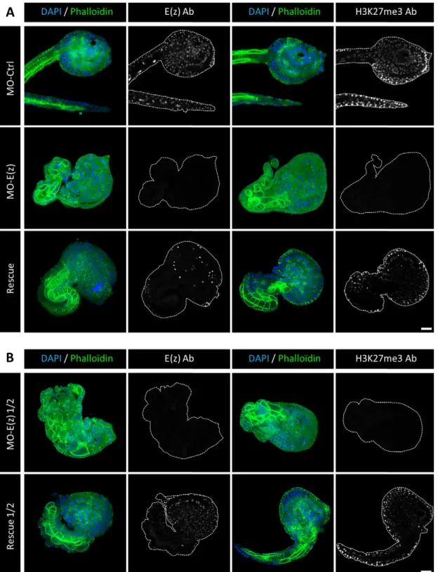Fig. 6. Ci-E(z) and H3K27me3 detection in rescue experiments. Comparative indirect immunofluorescence analysis between (A) control embryos, Ci-E(z) morphants, rescue embryos and (B) Ci-E(z) morphants ½ and rescue ½ embryos at late tailbud stage of developm