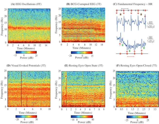 Figure 2-2: BCG is Harmonic in Heart Rate. EEG spectrograms recorded outside the scanner (A) and in 3 T MRI scanner (B) on 2 subjects undergoing similar levels of deep propofol anesthesia