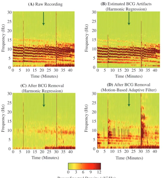 Figure 2-6: Harmonic Regression Algorithm Effectively Removes BCG Artifacts from Oscil- Oscil-latory Brain Dynamics Recorded at 3 T - Spectral Domain Results