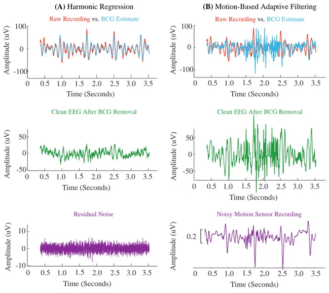 Figure 2-7: Harmonic Regression Algorithm Effectively Removes BCG Artifacts from Os- Os-cillatory Brain Activity Recorded at 3 T - Time Domain Results