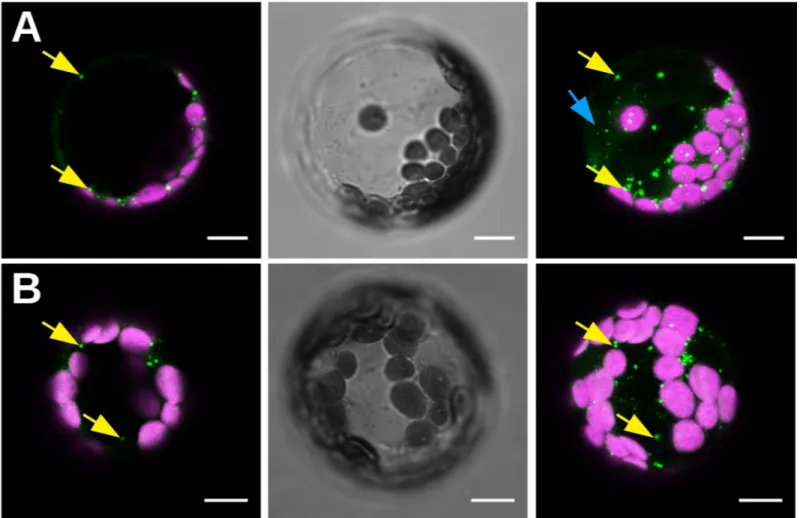 Fig 6. Observation of CaMV 11P6 -transfected A. thaliana GFP1-10 protoplasts. Protoplasts were transfected with infectious CaMV 11P6 plasmid (A) or with CaMV 11P6