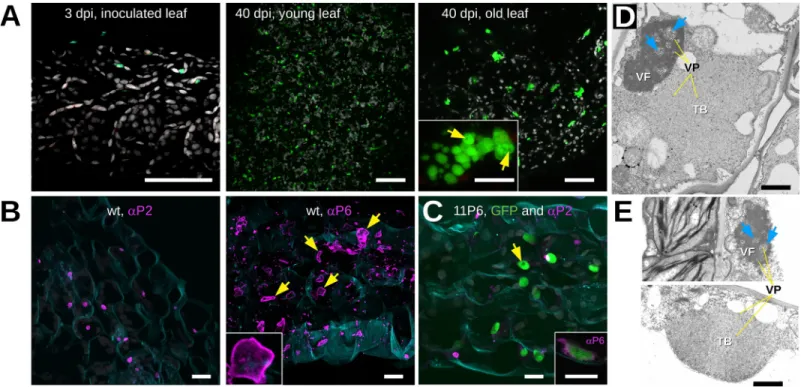 Fig 5. Microscopic analysis of CaMV 11P6 -infected A. thaliana. (A) Arabidopsis thaliana GFP1-10 leaves were analyzed by confocal fluorescence microscopy at 3 and 40 days after inoculation (dpi) with CaMV 11P6 