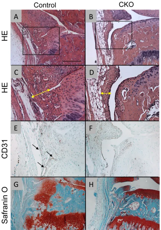 Fig 5. Synovial changes in control and α 5 CKO mice after OA surgery. The knee joints were harvested from control (A, C, E and G) and α 5 CKO (B, D, F and H) 4 weeks after OA surgery