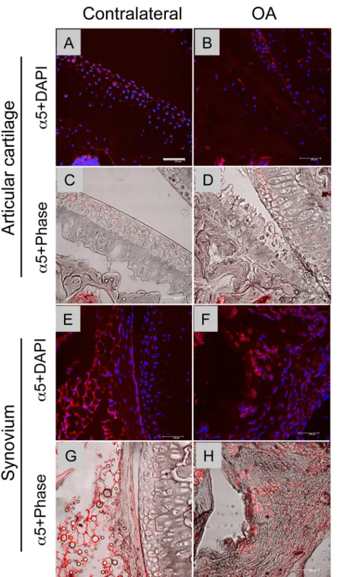 Fig 7. Distribution of α 5 integrin in the OA and healthy knee joints. The knee joints were harvested from the surgery site (B, D, F and H) and the contralateral site (A, C, E and G) 4 weeks after OA surgery