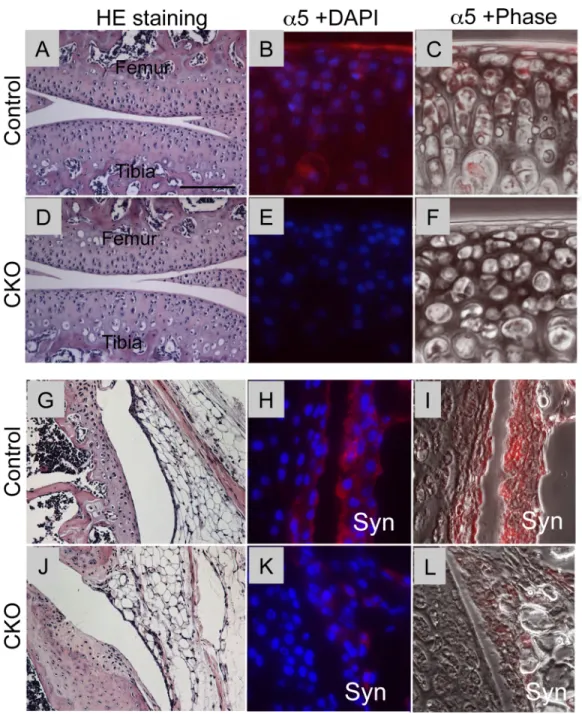 Fig 1. Histology and expression of α 5 integrin in synovial joints in control and α 5 CKO mice
