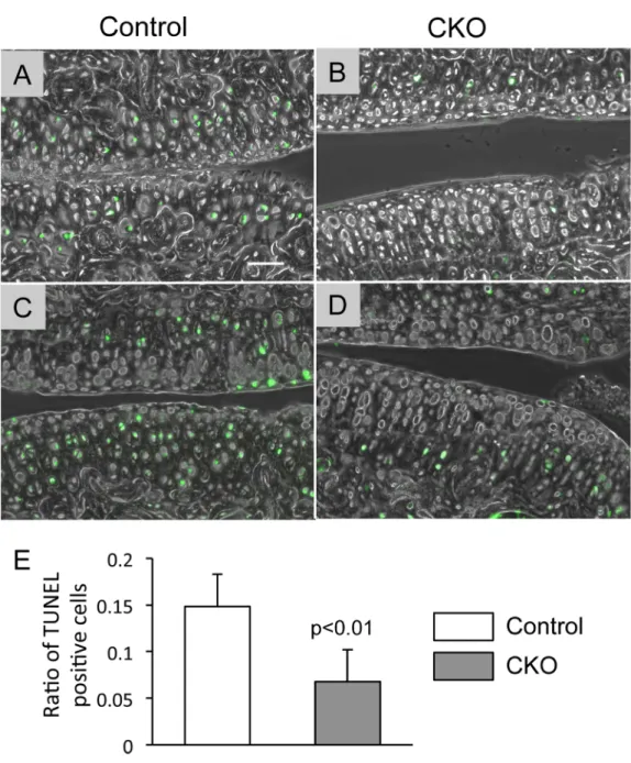 Fig 4. Apoptotic cells in control and α 5 CKO articular cartilage after OA surgery. The knee joints were harvested from control (A and C) and α 5 CKO (B and D) 4 weeks after OA surgery
