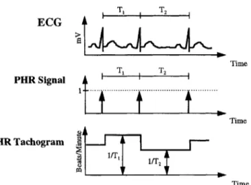 Figure  2-2.  Derivation of HRT from ECG.