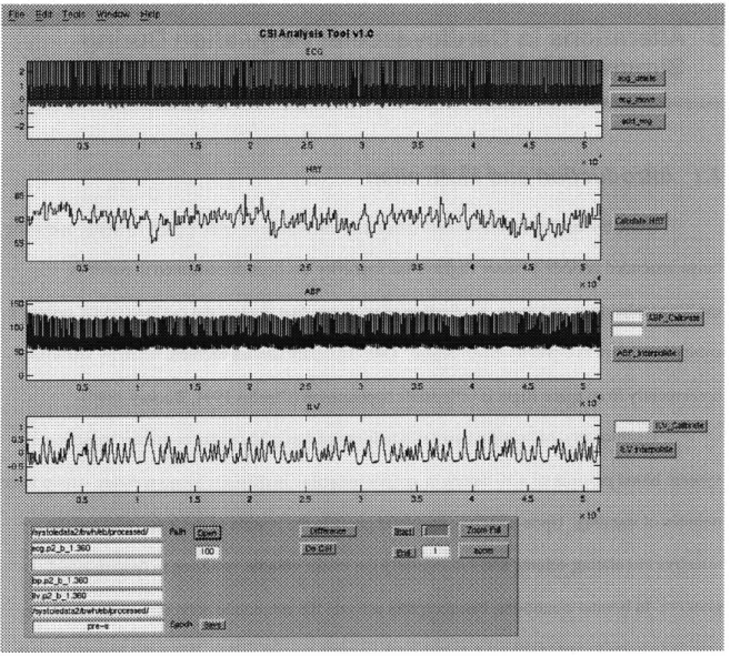 Figure 2-4.  Screenshot of the  CSI Analysis  Tool.