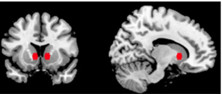 Fig 1. Nucleus Accumbens Seed. Bilateral nucleus accumbens seed used in resting-state functional connectivity analysis