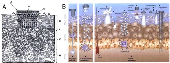 Figure  1-4:  Schematic  of  MNs  and  their  interaction  with  the  dermis  and  epidermis