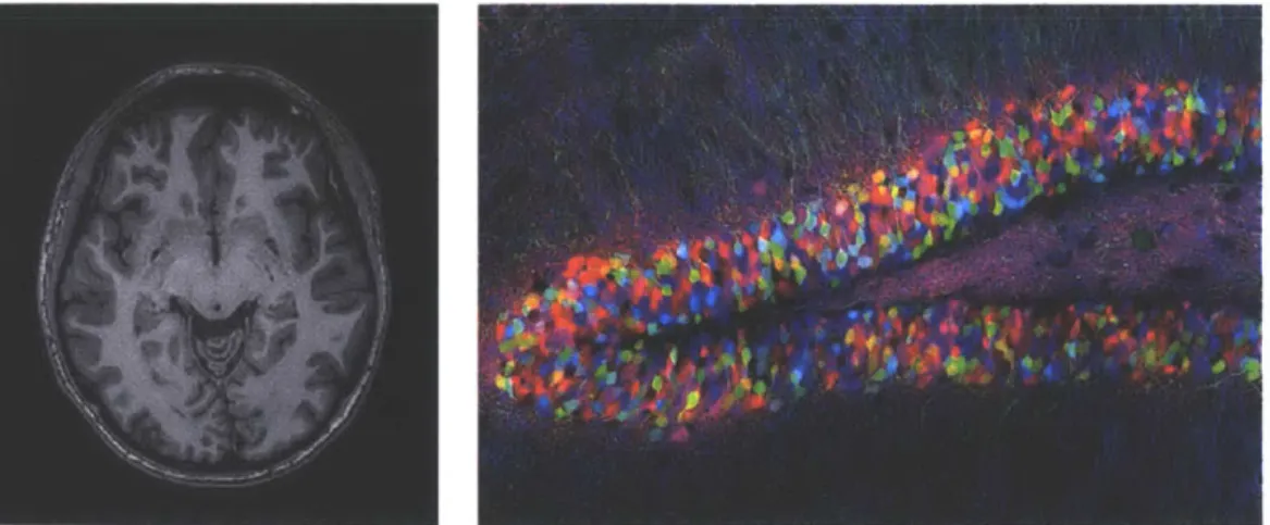 Figure  2-3:  Left:  fMRI  image  of the  author's  brain;  Right:  A  Brainbow  image  [211.