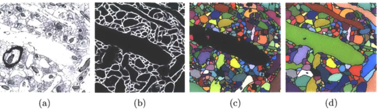 Figure  3-1:  2-D  visualization  of the  stages  of an  agglomeration-based  connectomics pipeline:  (a)  Electron microscope  (EM)  image