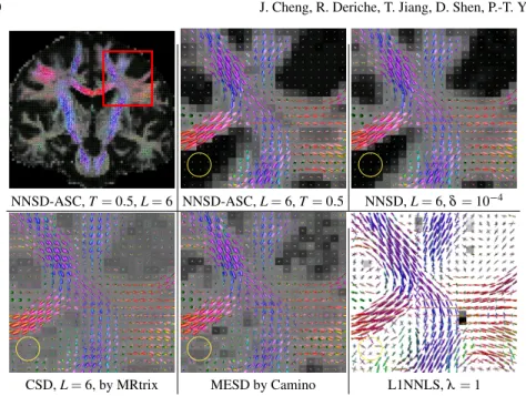 Fig. 2 First row: the whole coronal view of the fODF field using NNSD-ASC with T = 0 : 5, and close-up views of results generated using NNSD-ASC and NNSD