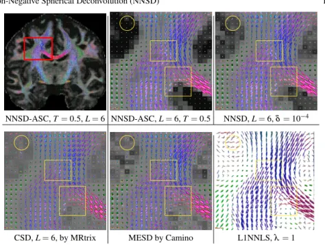 Fig. 3 First row: coronal view of the fODF field estimated using NNSD-ASC with T = 0 : 5, and close-up views of results generated using NNSD-ASC and NNSD