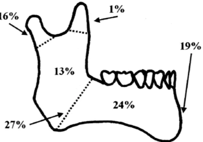 Figure  1-2:  Fracture  Occurance  for  Different  Regions  of the  Mandible